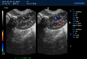 S80高端便攜獸用彩超-彩色多普勒多普勒超聲診斷儀