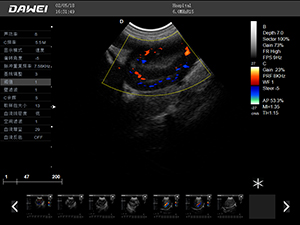 S9推車式獸用彩超機(jī)-寵物b超機(jī)掃描圖